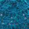 Rapt Hearts Beanie Crochet Pattern - Super close-up of hearts towards the crown - in teal pure wool